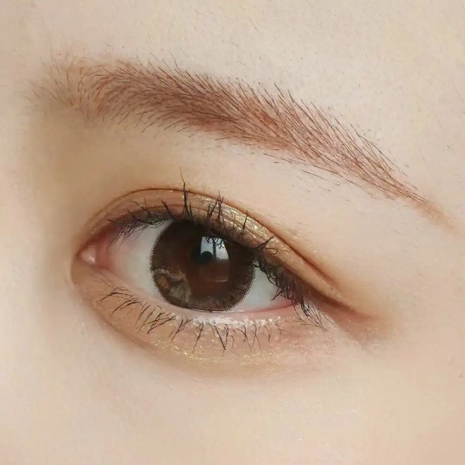 密眼周年轮重获青春双眼不是梦龙8国际龙8网站杭州美莱：解(图2)